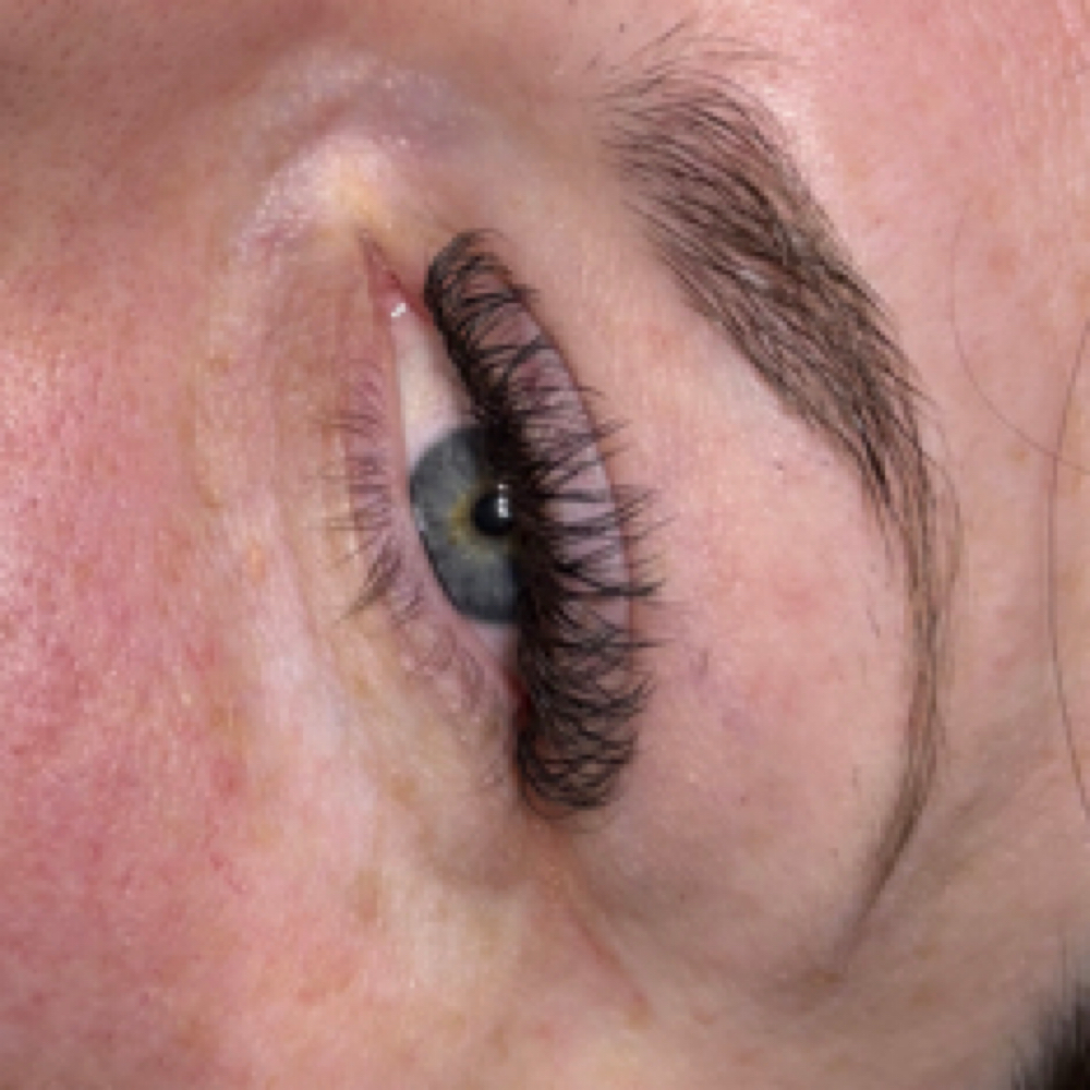 YY Fill at C Beauty Bar Aesthetic in Abilene, TX