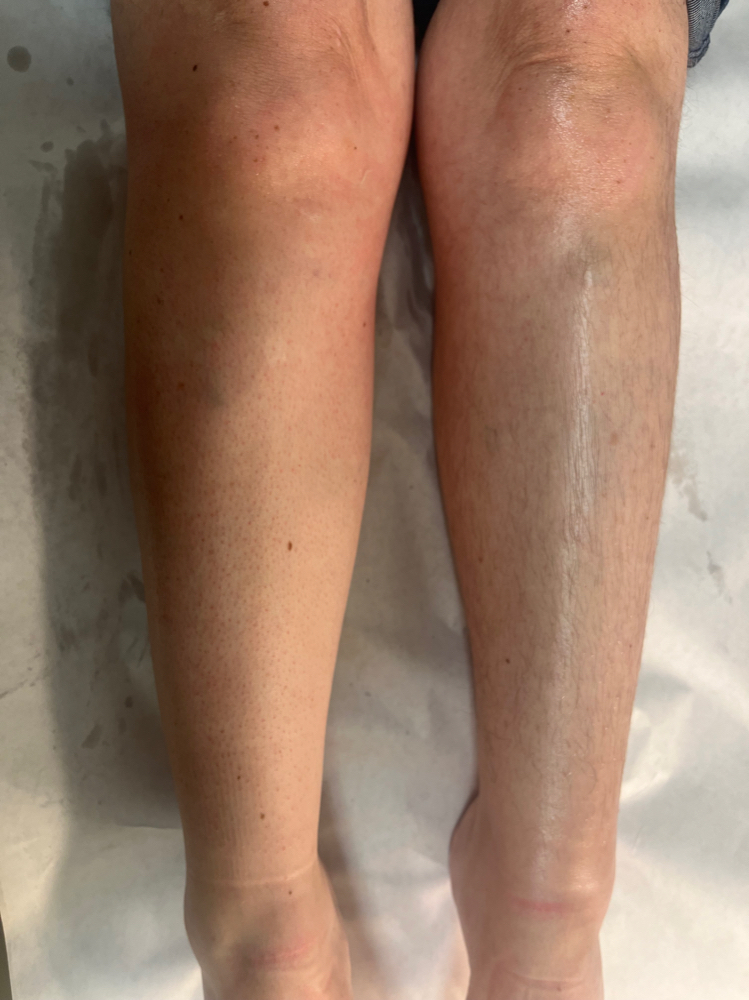 Lower Leg Wax