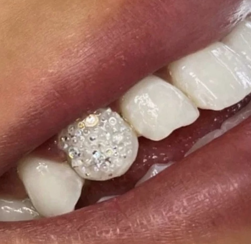 Chandelier Tooth at MK Beauty Salon in Salamanca, NY