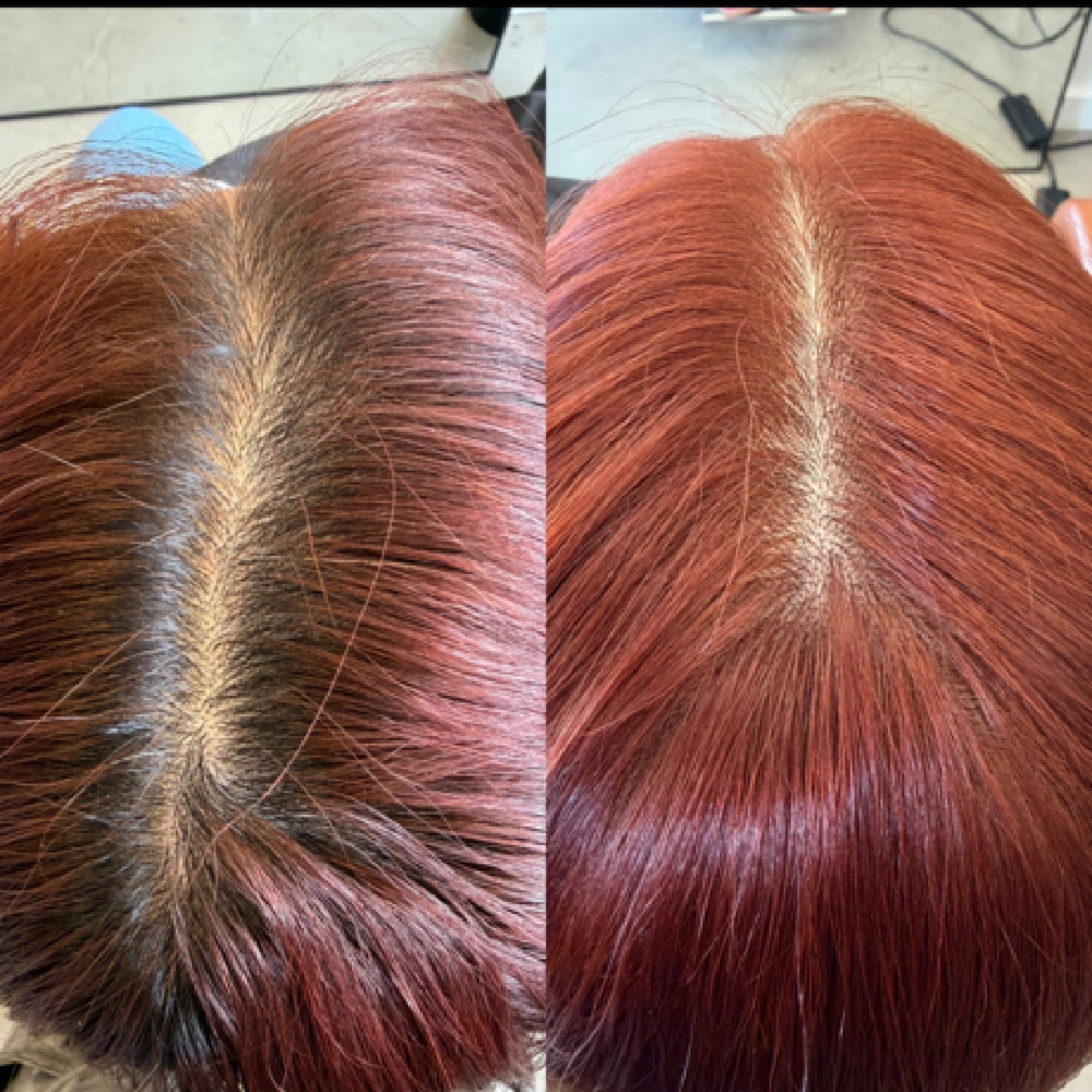 Calecim Treatment (12 Week) at LTORRESxHAIR ✨ in Richardson, TX