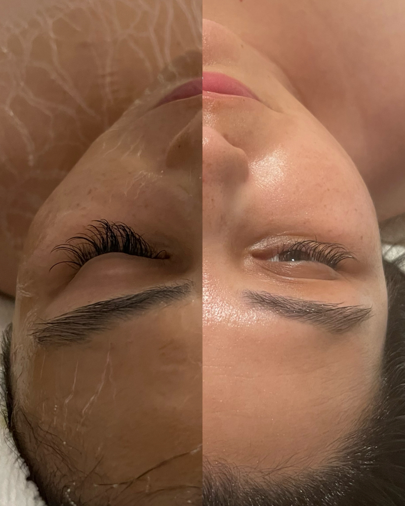 Firming Peptide Treatment