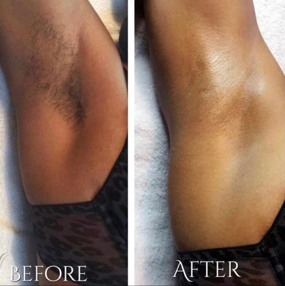 Underarm at Mo3 Beauty Studio in Vestavia Hills, AL