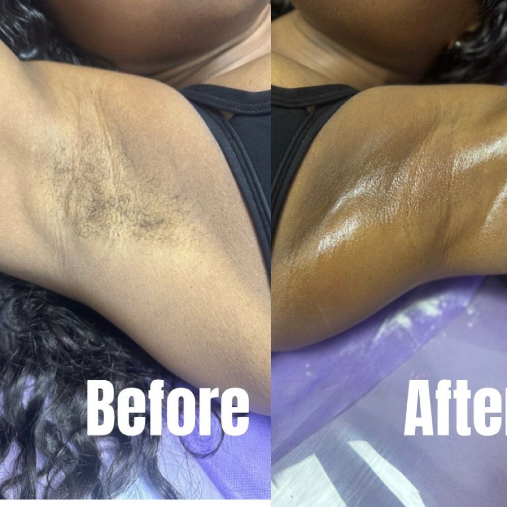 Underarm at Mo3 Beauty Studio in Vestavia Hills, AL