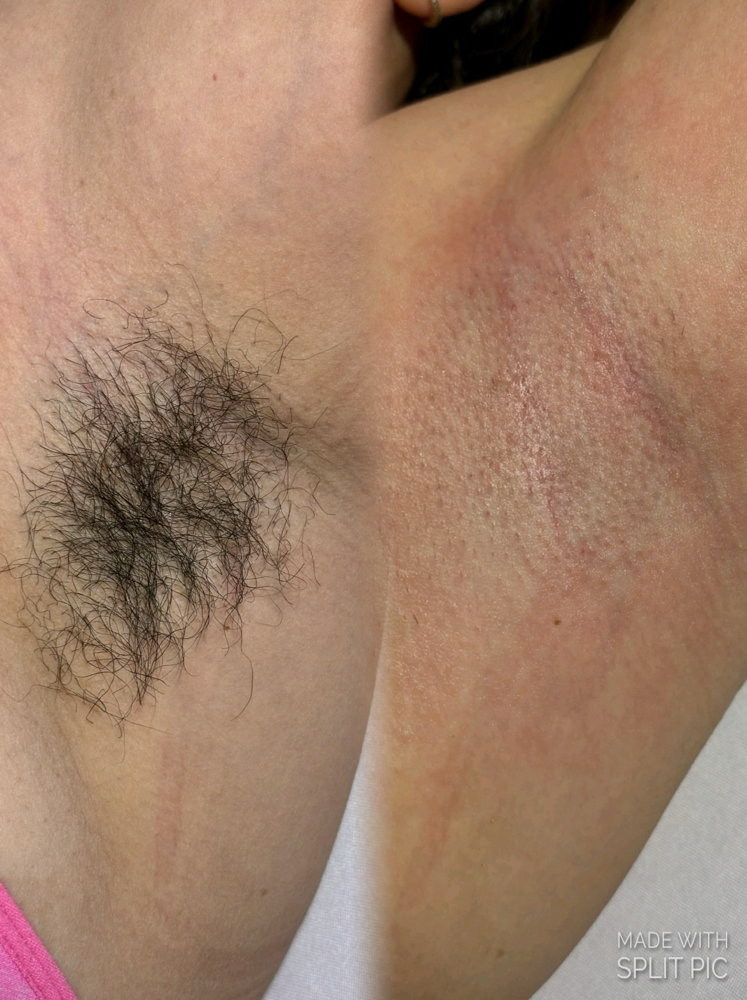 Underarm Wax