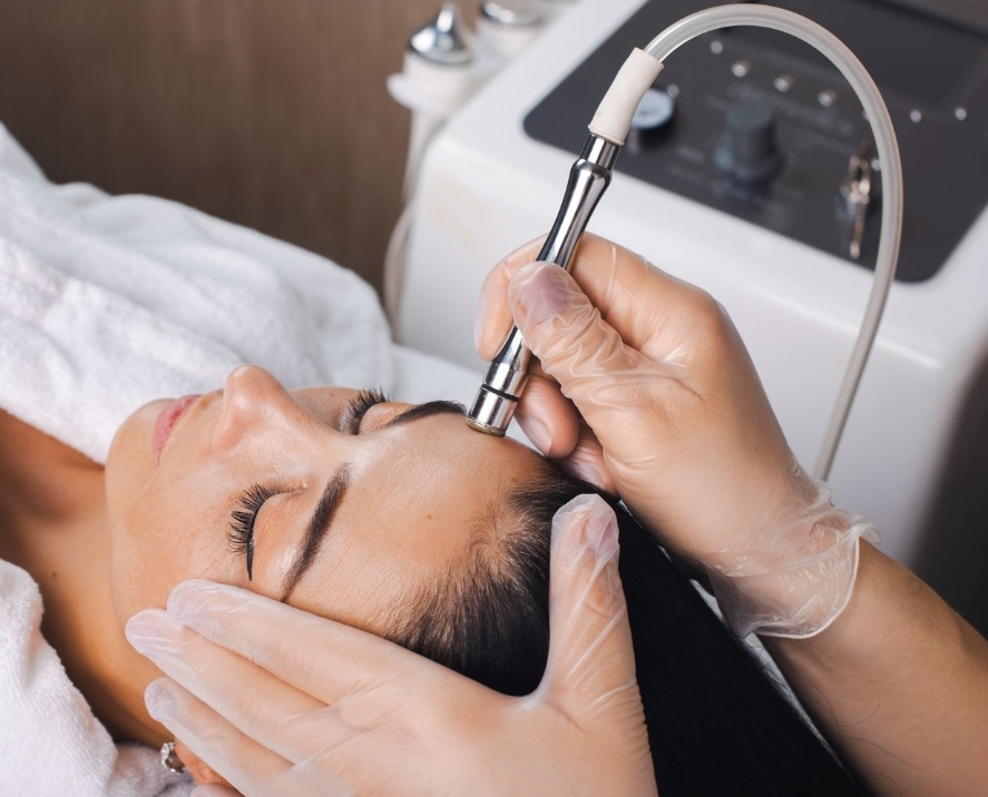 Microdermabraision Facial