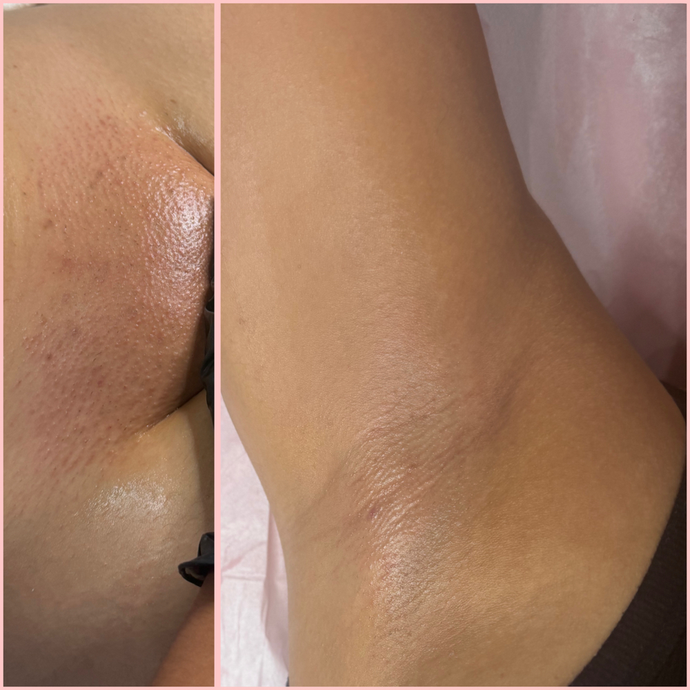 Brazilian + underarms ✨ at The Luxurious Wax in Rochester, NY