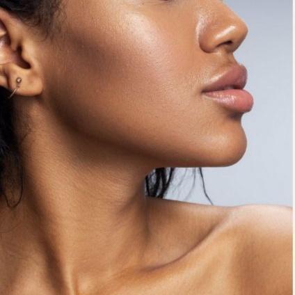 Dermal Fillers at Injector Savanna in Atlanta, GA