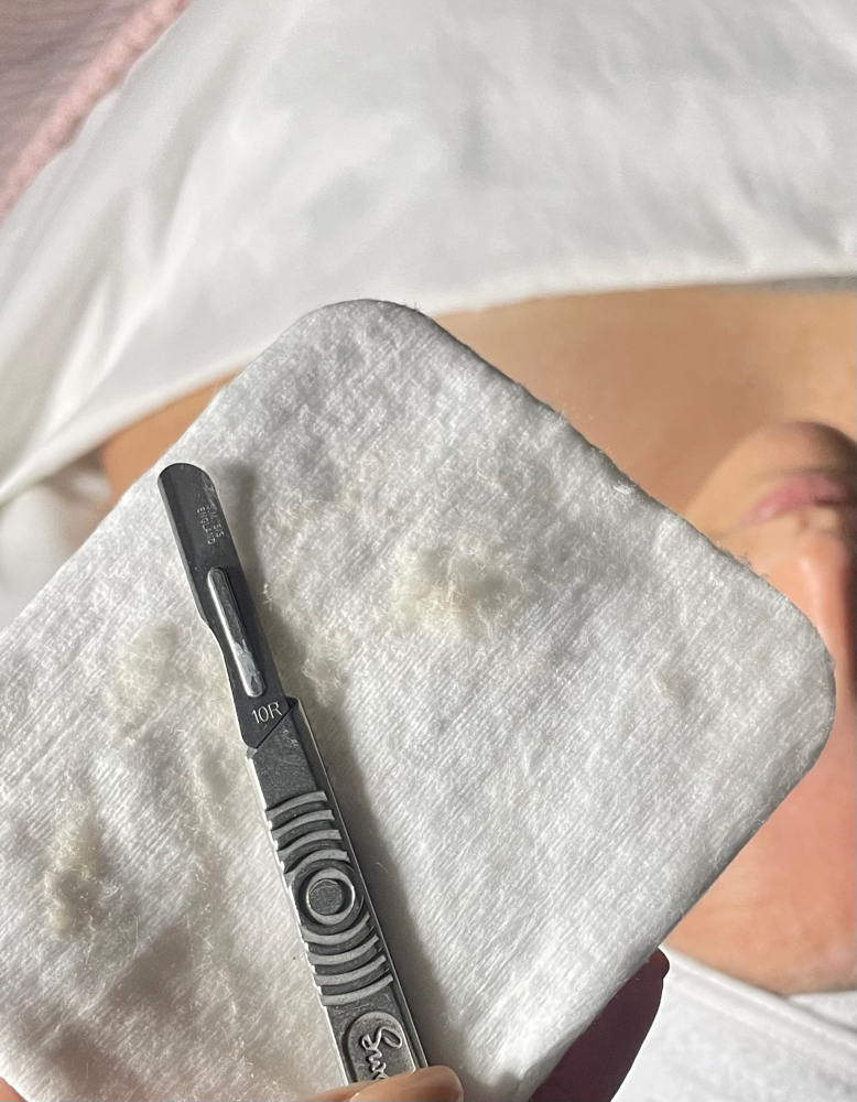 Dermaplane Treatment