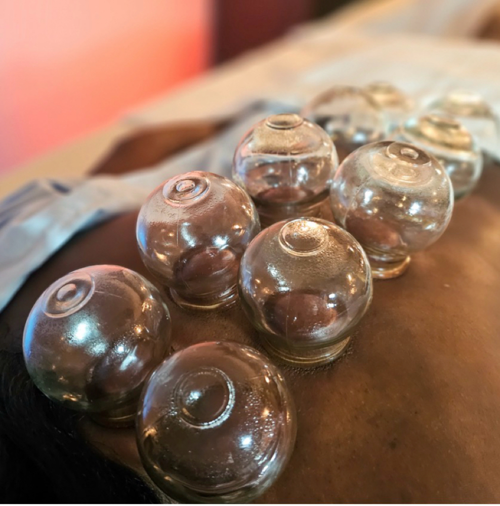 Cupping - Enhancement at Darla’s Mobile Massage in Nashville, TN