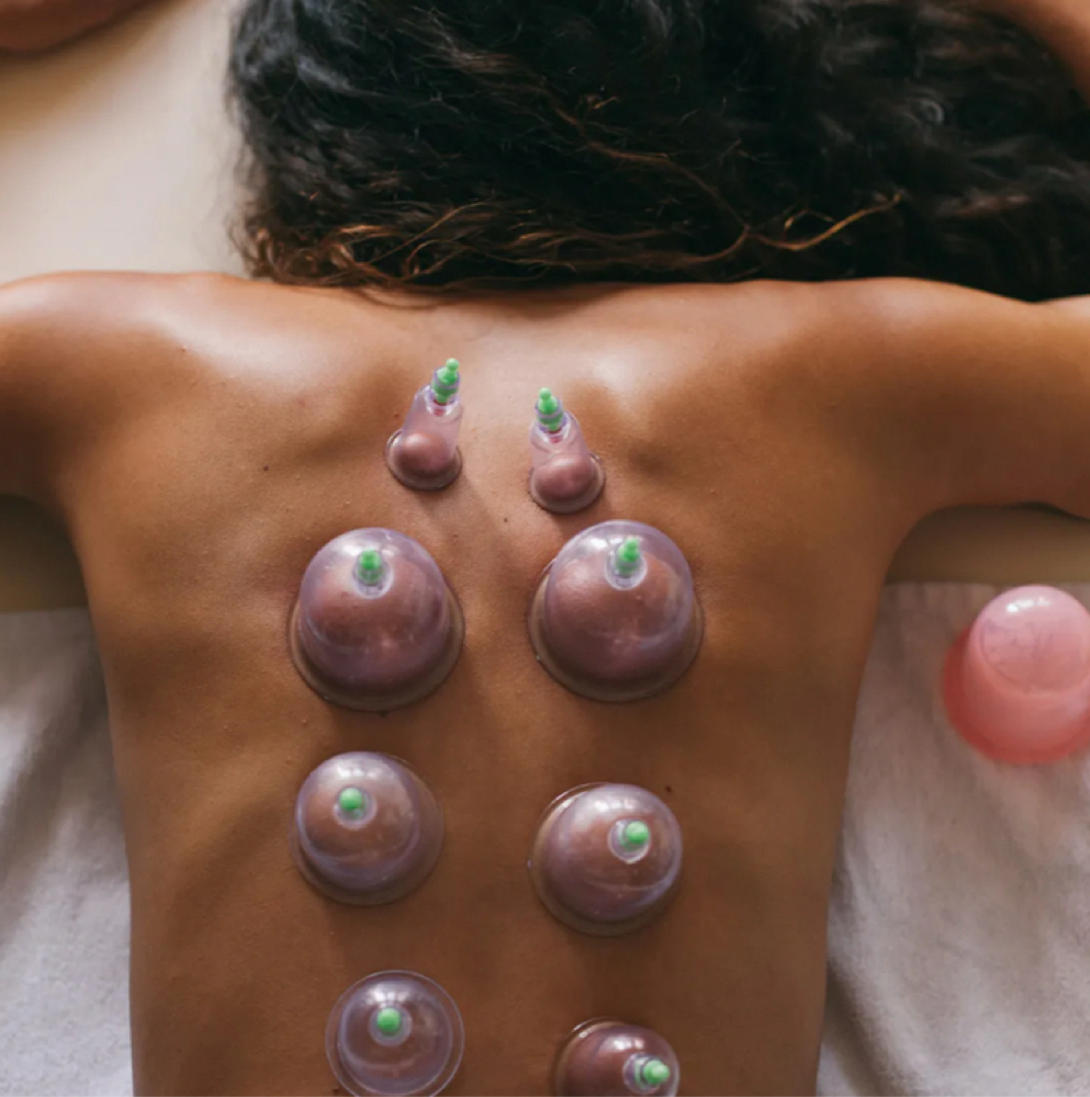Cupping - Enhancement at Darla’s Mobile Massage in Columbia, TN