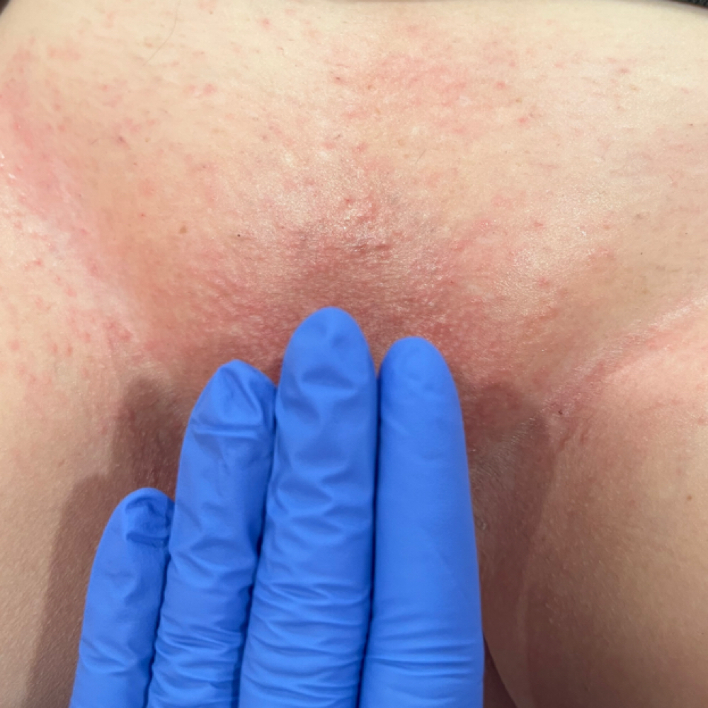 Brazilian Wax at Pretti Selfish Beauty in Columbia, MO