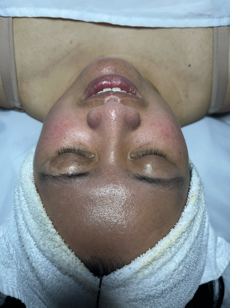 Customized facial (1 time)