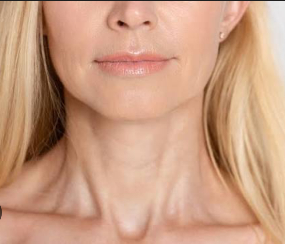 Botox Neck Bands
