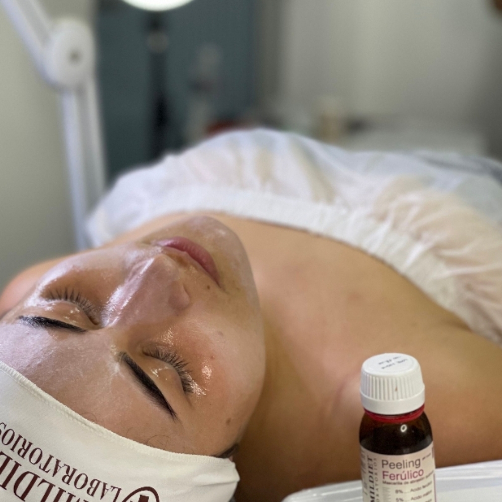 Chemical Peel Consult at Pore Decisions Esthetics LLC in Hinesville, GA