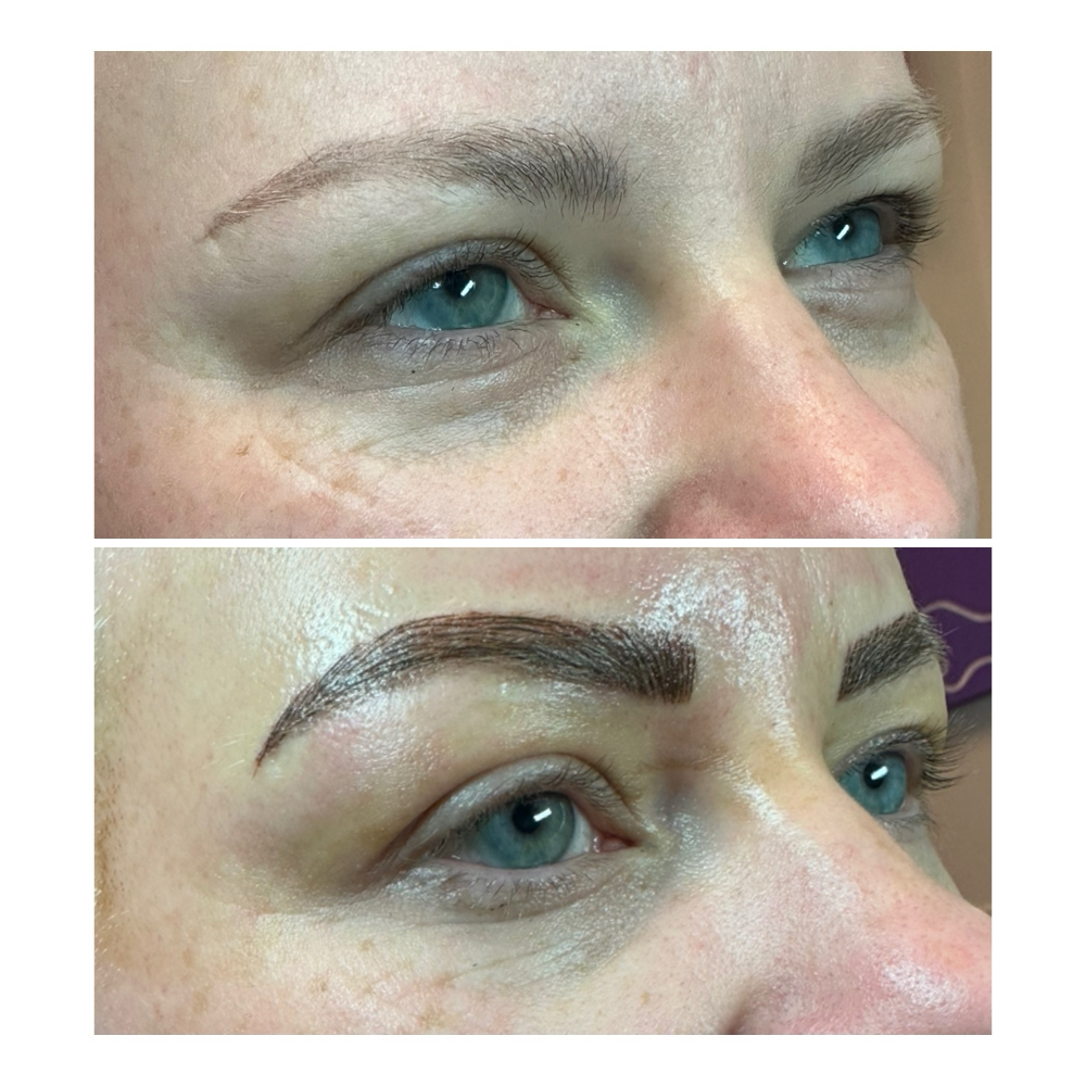 Combination Brow