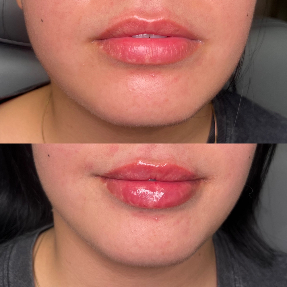 Mini Lip Plump