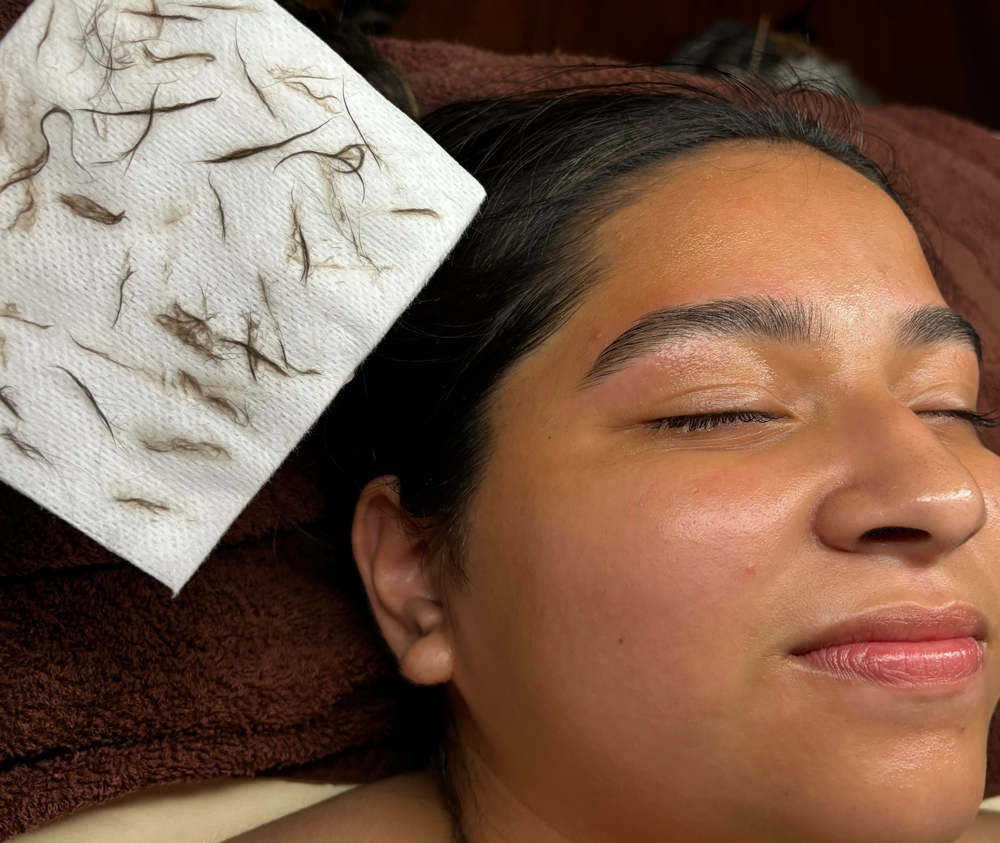 Dermaplane Facial