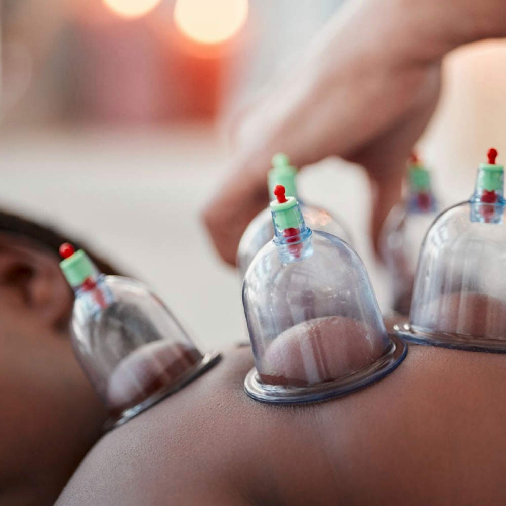 Cupping Therapy - Add On at Well Kept - Therapeutic Wellness Studio in Bradenton, FL