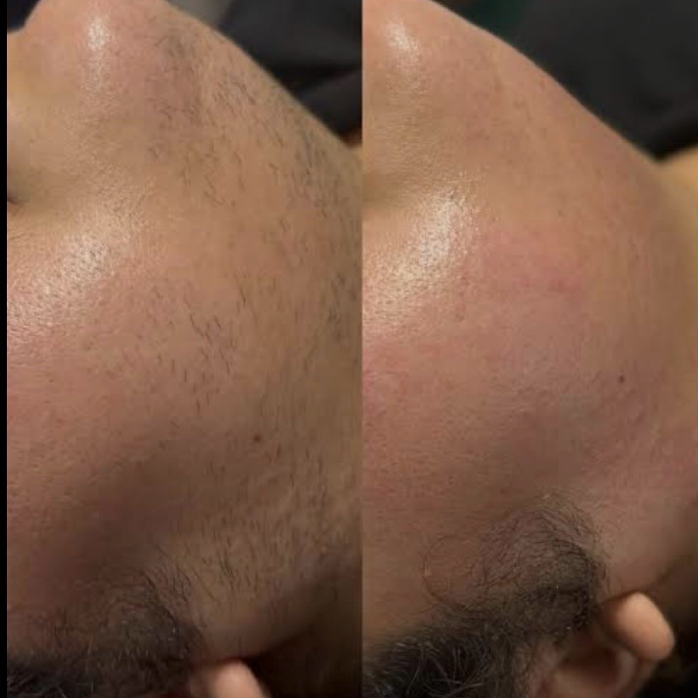 Chin Wax Or PCOS Waxing at Pretty Lady Esthetics in Ontario, OH