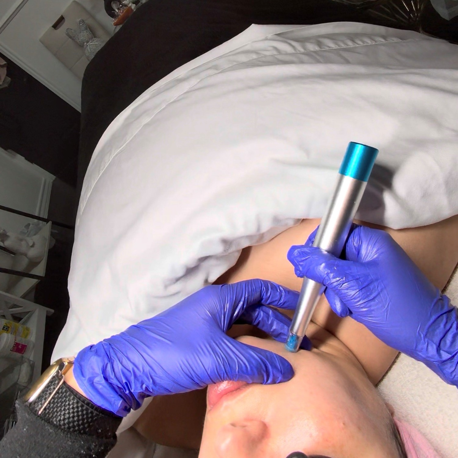 ReZENerate Nano Infusion Package at Santana Skin Studio in El Paso, TX