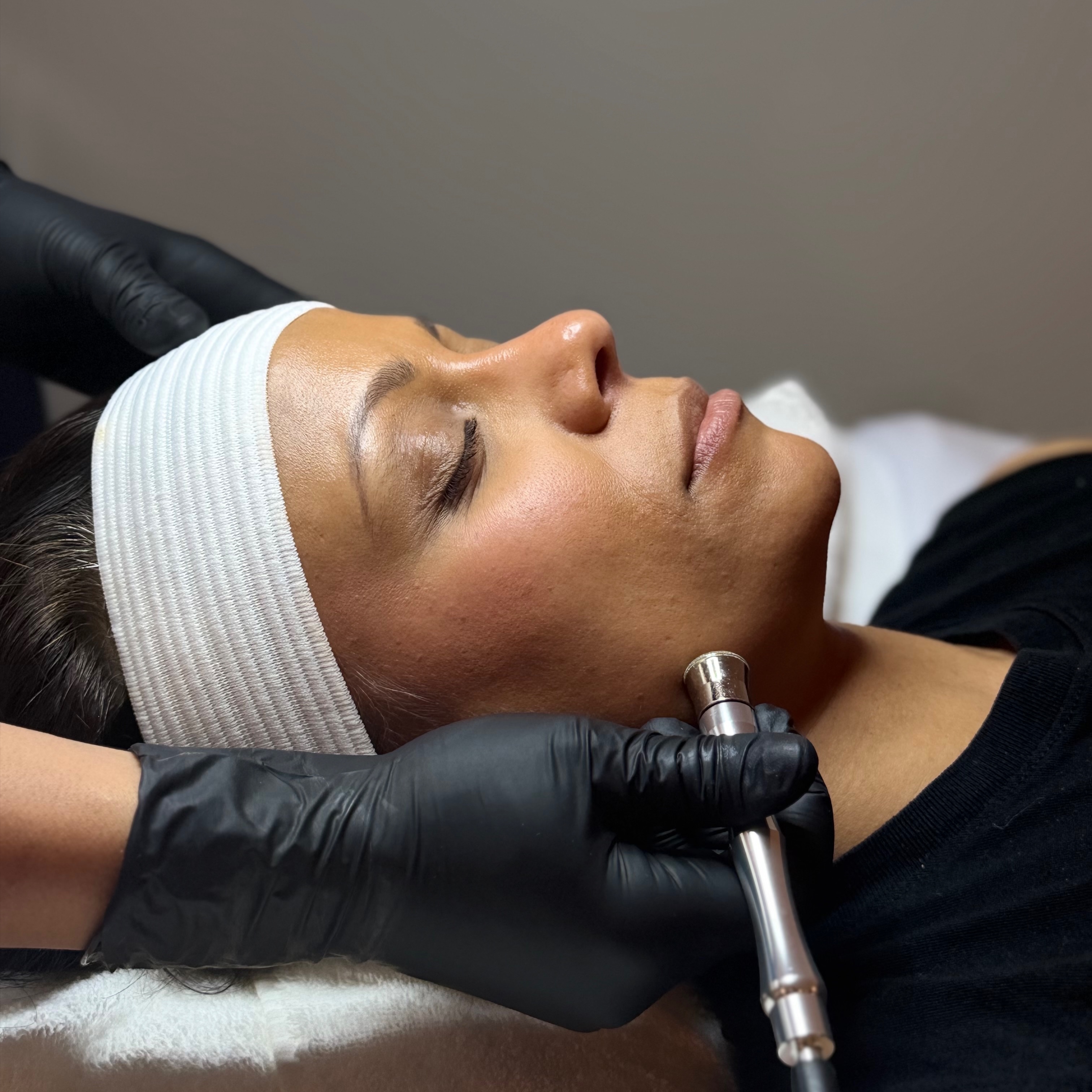 Microdermabrasion Facial at Tillie's Skincare Studio in Rockland, MA