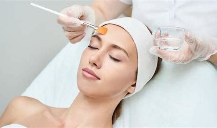 Chemical Peel