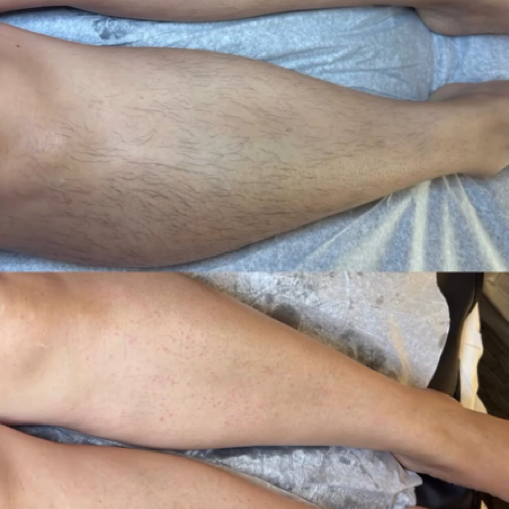 Full Leg at Les Talk Beautie in Riverside, CA