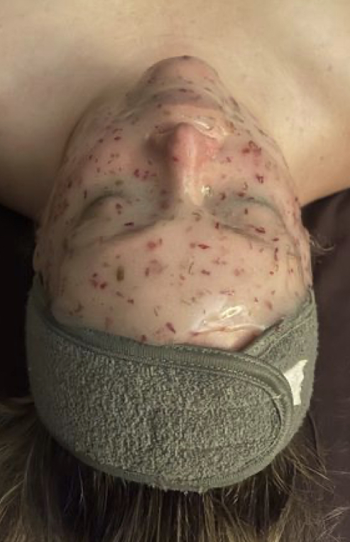 Oasis Facial With Jelly Mask