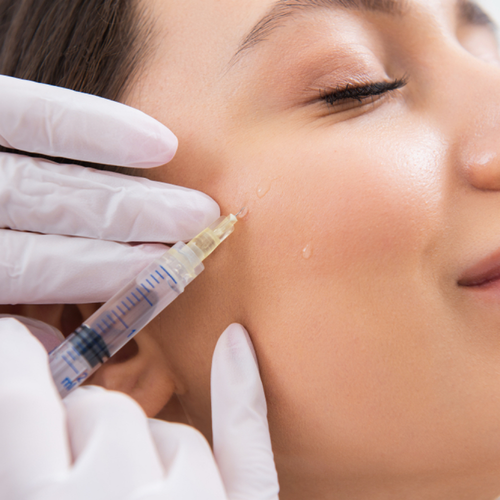 CHEEK FILLER 1ml at Irena Studio & Academy in McAllen, TX