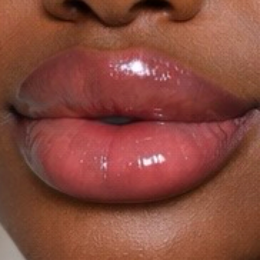 2 ML Lip Enhancement 👄