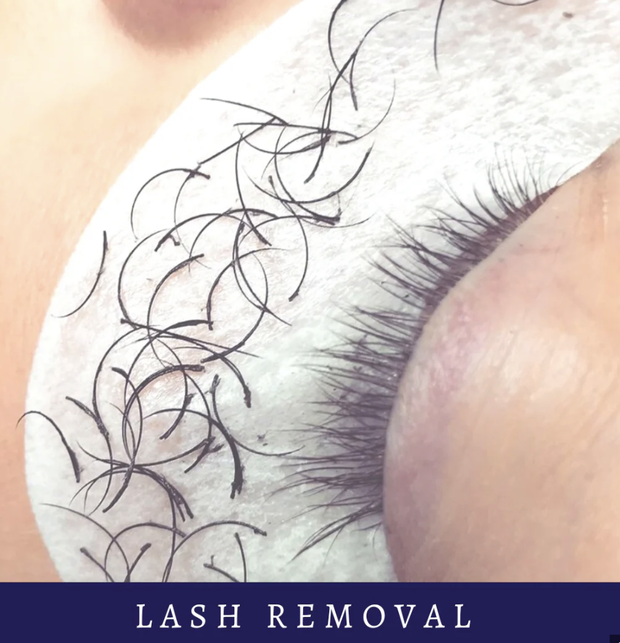 Lash removal