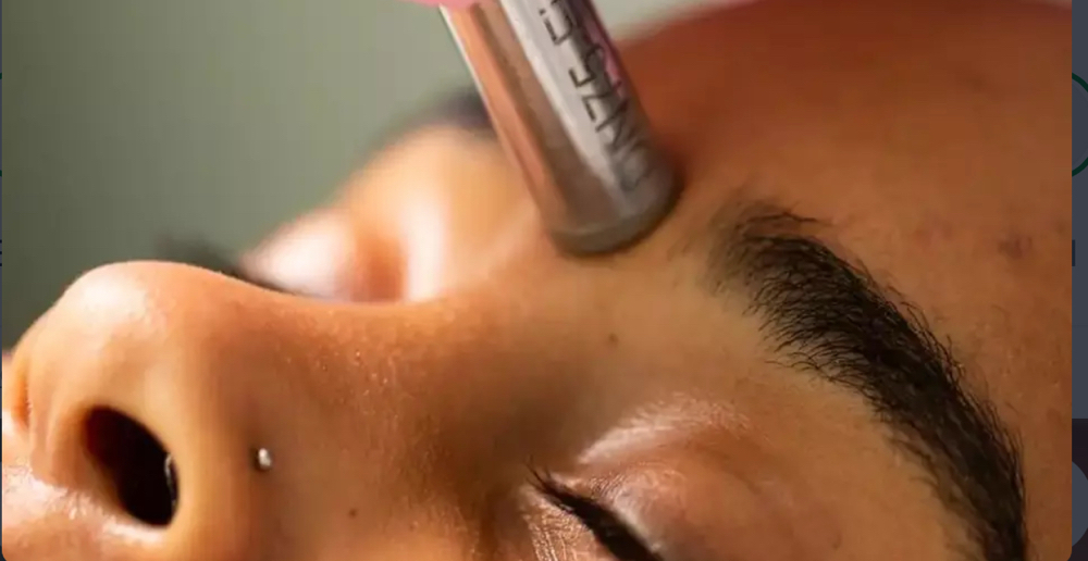 Micro Needling