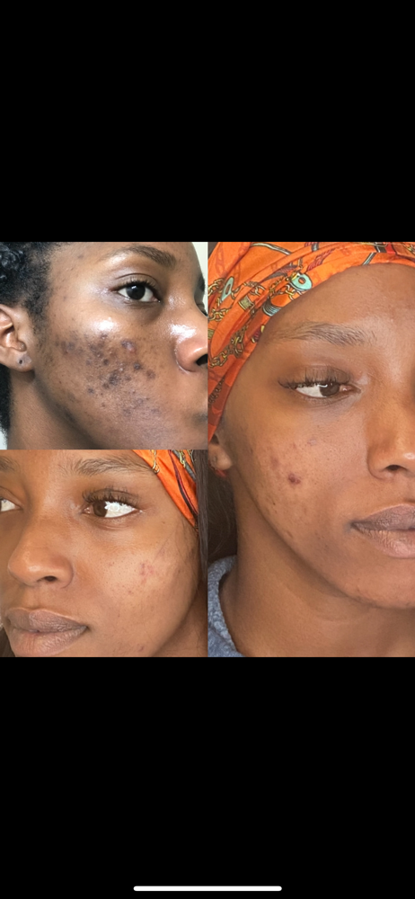 *Most Popular: Custom Facial