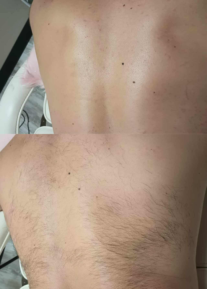 Back wax