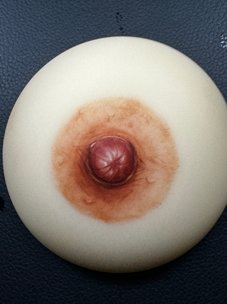 Bilateral 3D Areola Reconstruction