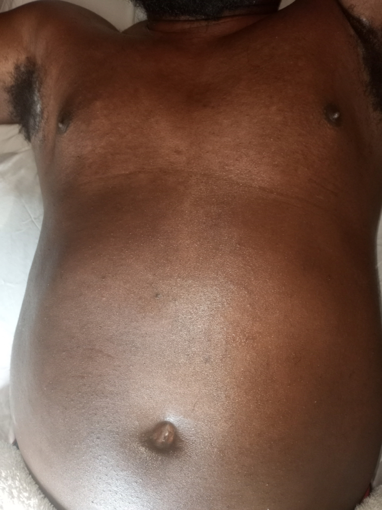 Mens Chest Sugaring