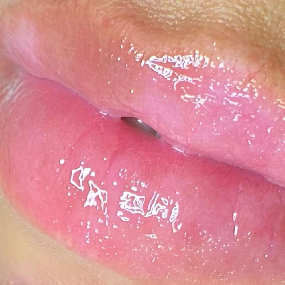 Hydro Lips