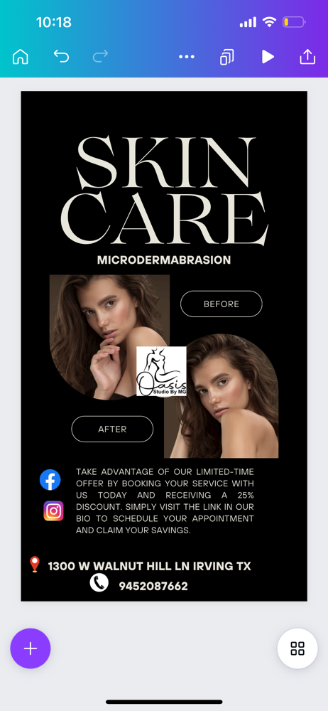 Microdermabracion