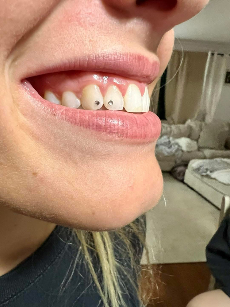 Teeth Gems at Ink Ice & Ivory LLC in Williston, ND