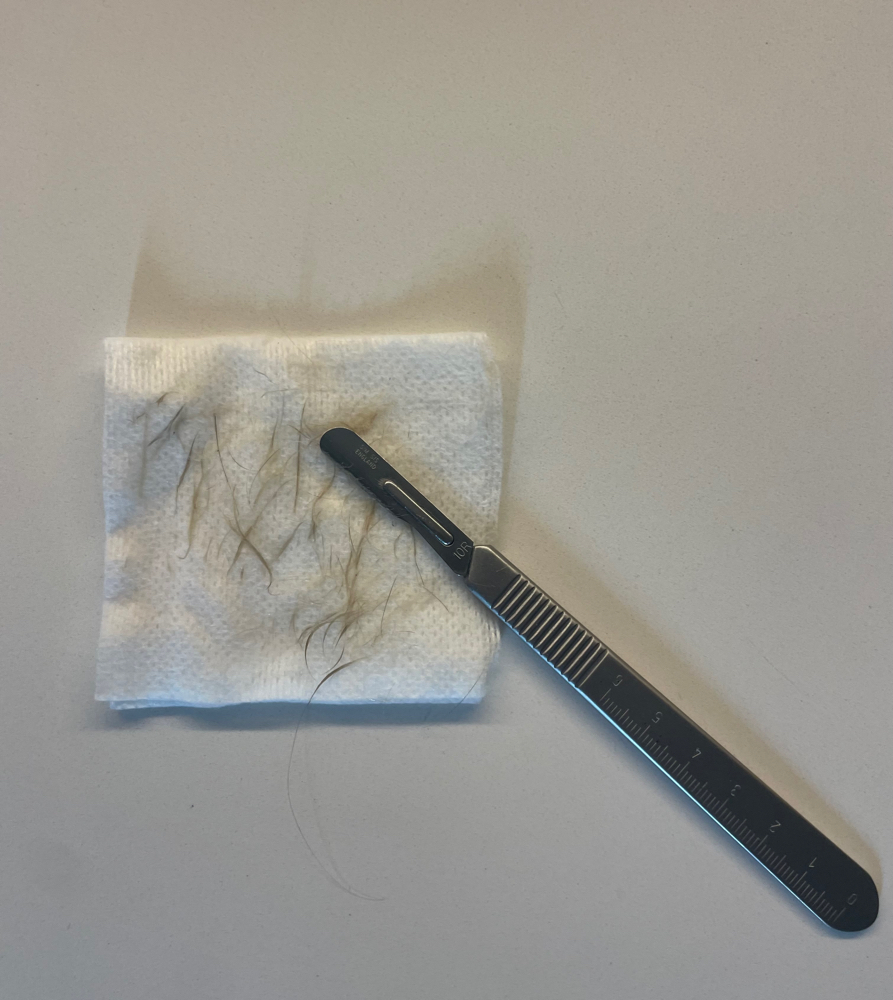Dermaplane - add on service