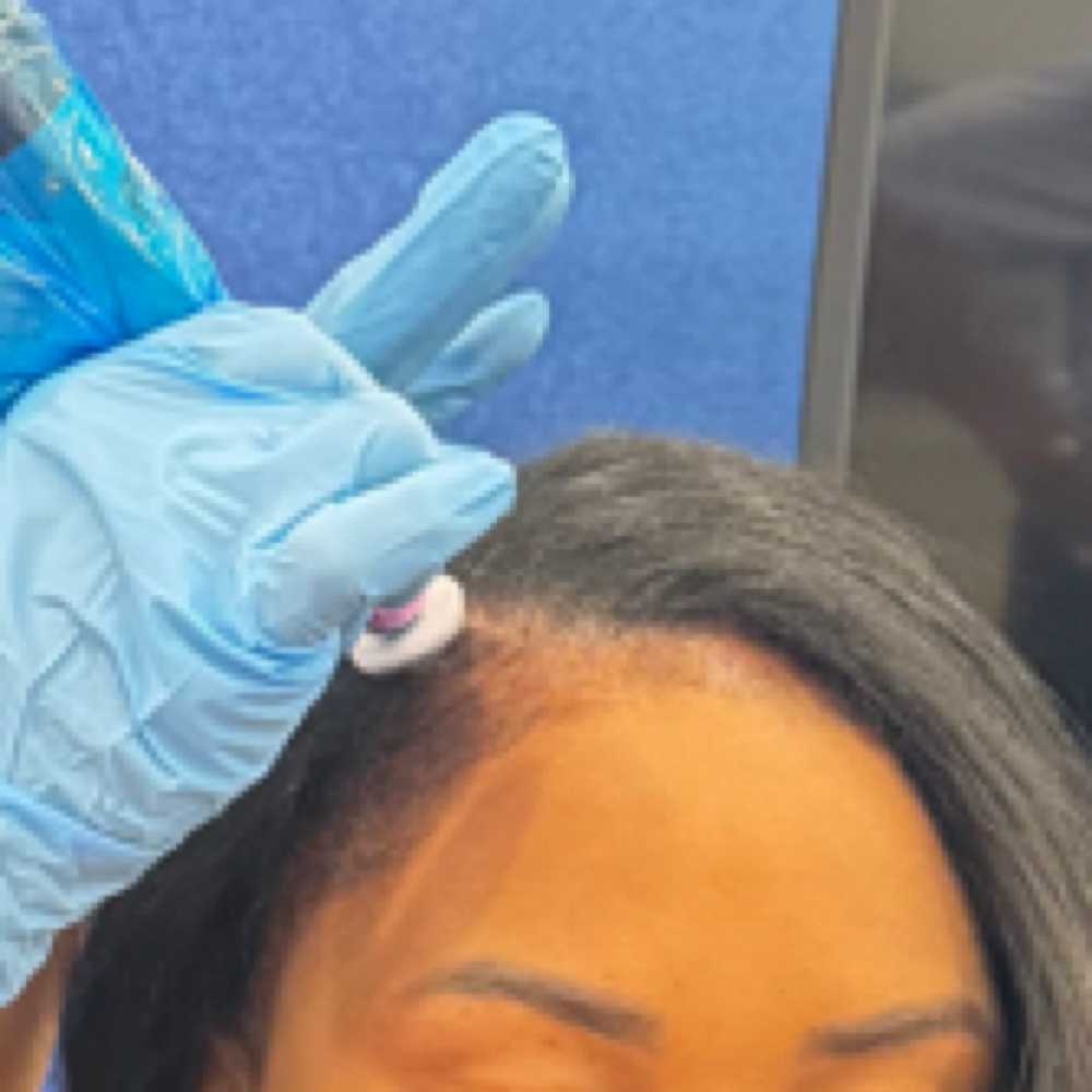 Procell Therapies Hair Growth at Ocean Waves Aesthetics in Oviedo, FL