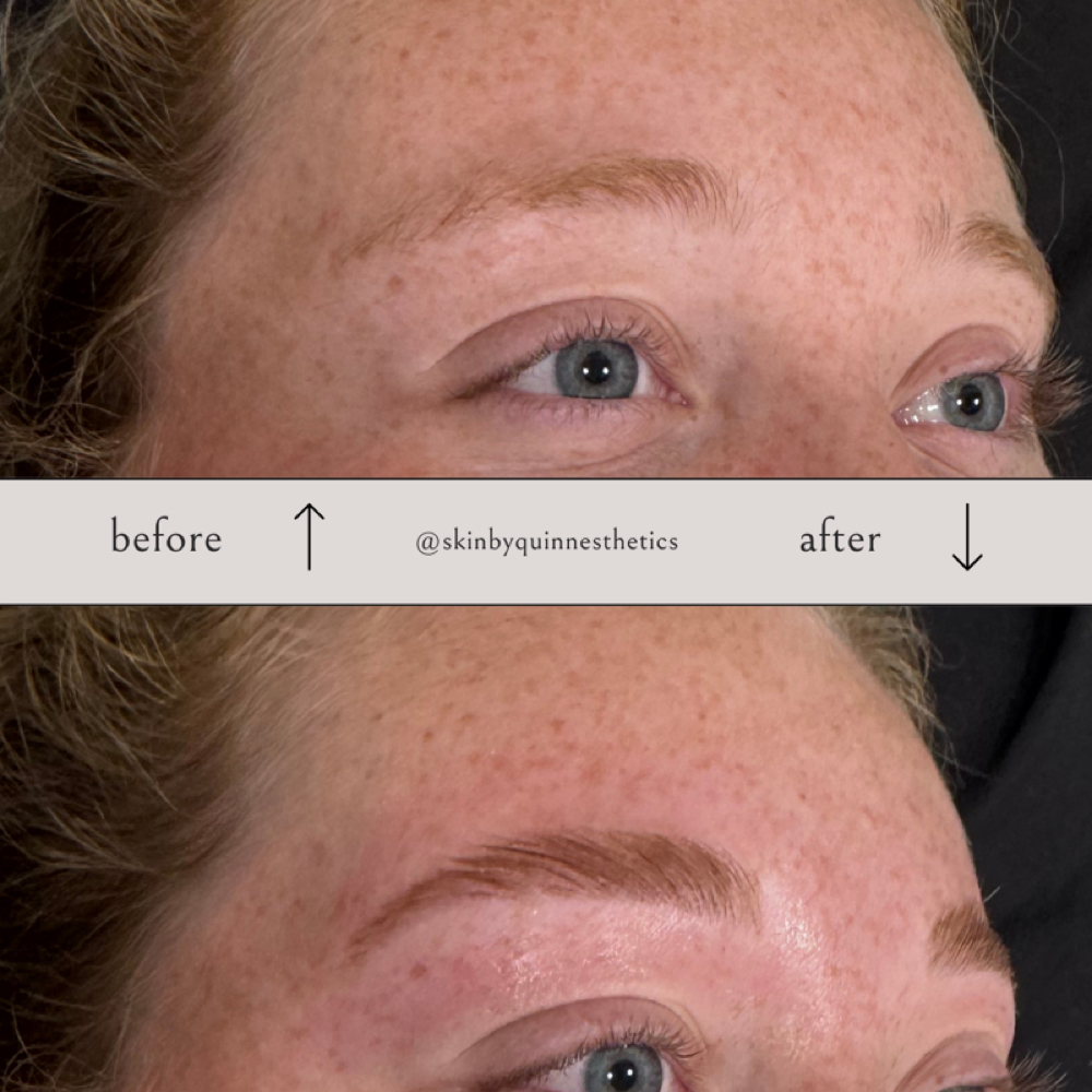 Full Brow Transformation at Skin by Quinn in Coralville, IA