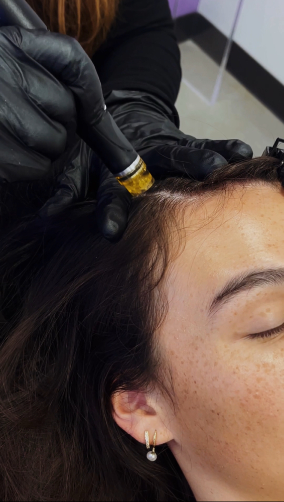 HydraFacial Scalp Treatment