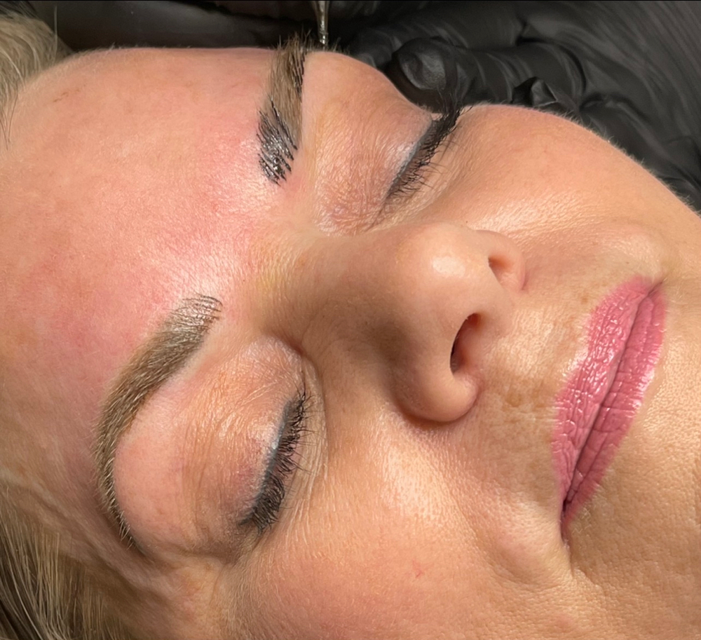 Brows - 6 To 8wk T-UP