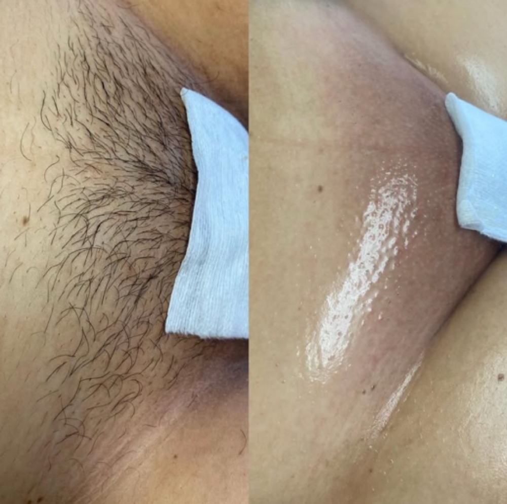 Brazilian Wax Returning:) at Sacred Lotus Collective LLC in Chandler, AZ
