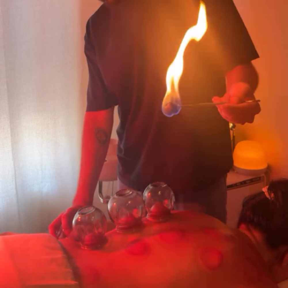 Add-On: Fire Cupping at Casa Copal Organic Spa in Dallas, TX