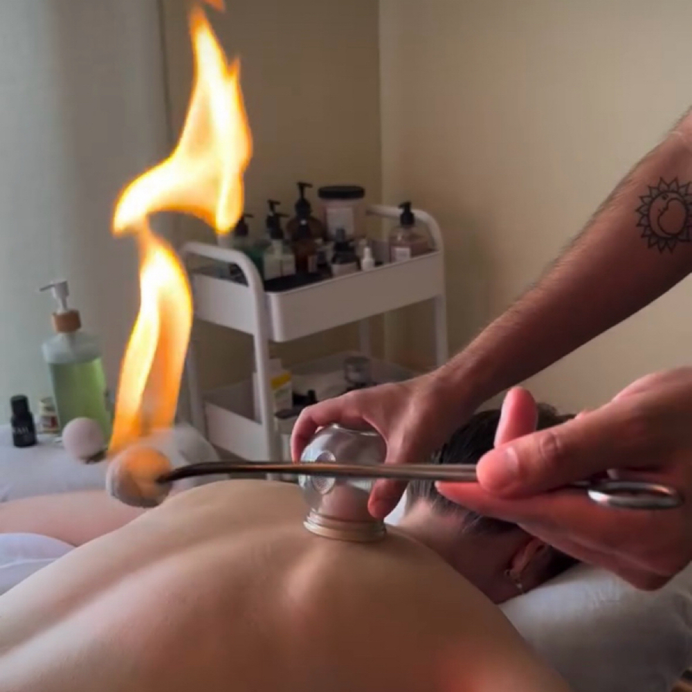 Add-On: Fire Cupping at Casa Copal Organic Spa in Dallas, TX
