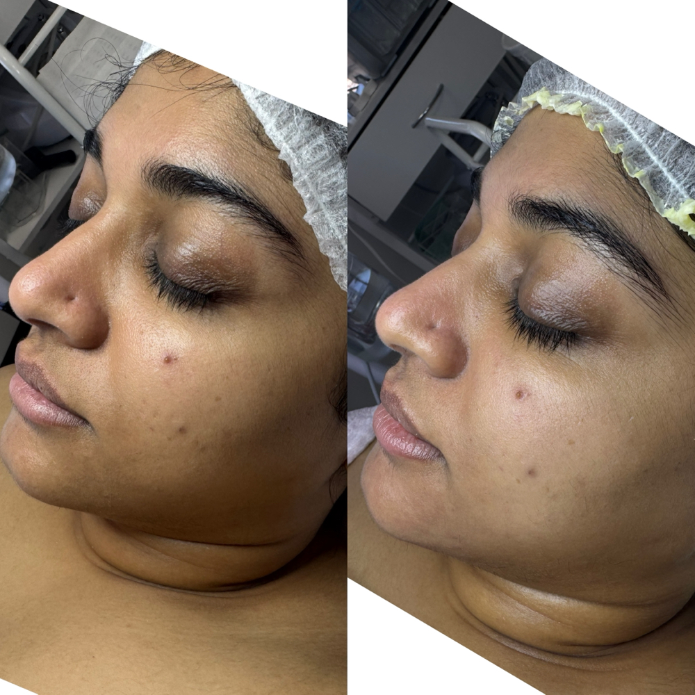 Lymphatic Massage + Glowing Session at Healthy skin by Alvina in Highland Park, IL