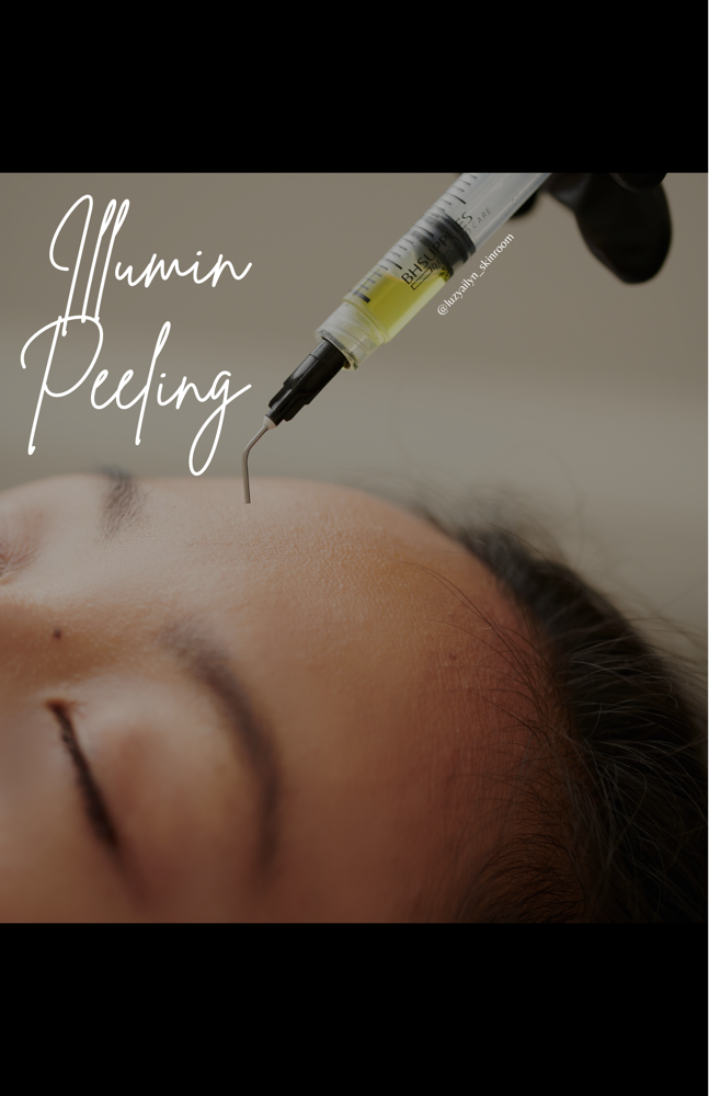 Korean Illumin Peel