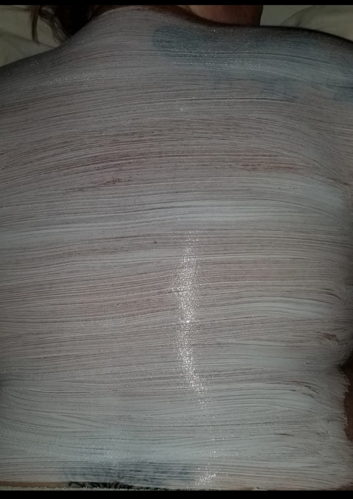 Back Treatment